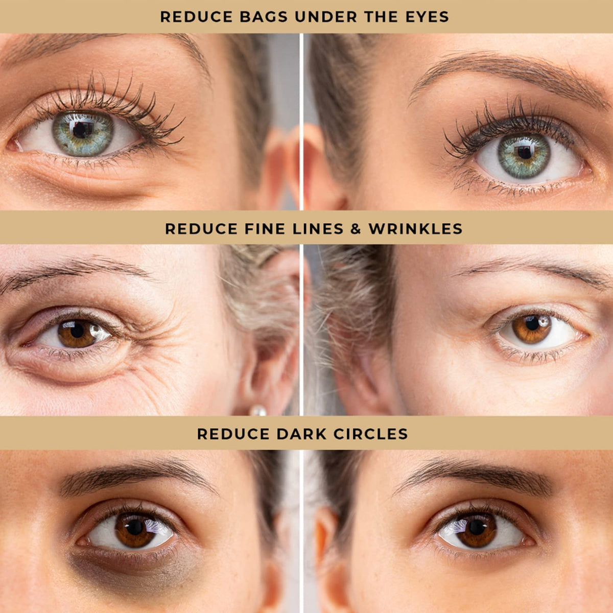 LPH LAB Temporary Eye Tightener (2 Pack) - Instant Under-Eye Bag & Dark Circle Remover