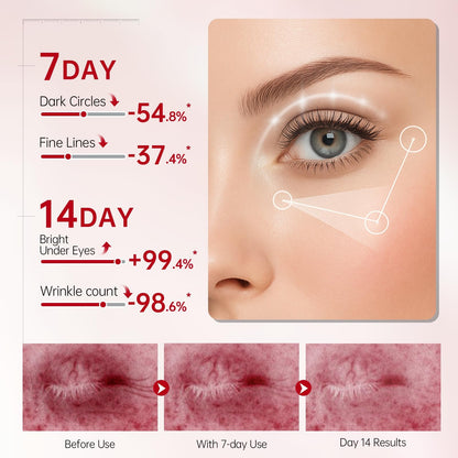 Peunitory Eye Balm Stick - Anti-Wrinkle & Brightening (0.32oz)
