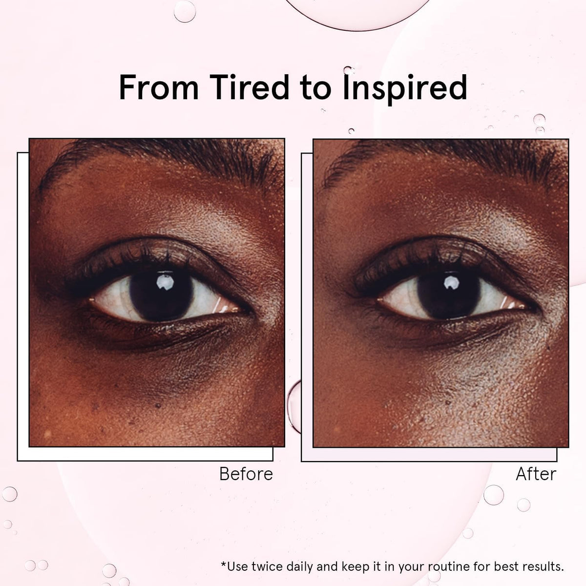 Grace & Stella Under Eye Brightener - 15ml (0.51oz) - Cooling Caffeine & Ceramide Eye Serum with Metal Rollerball
