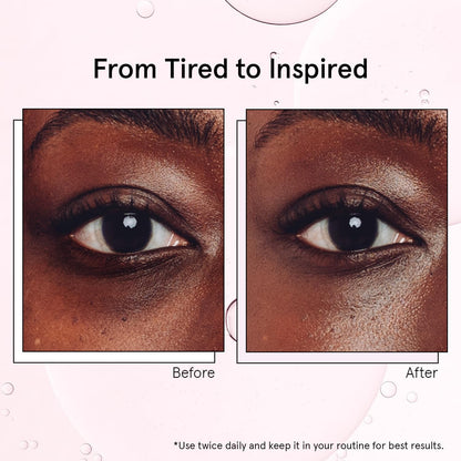 Grace & Stella Under Eye Brightener - 15ml (0.51oz) - Cooling Caffeine & Ceramide Eye Serum with Metal Rollerball