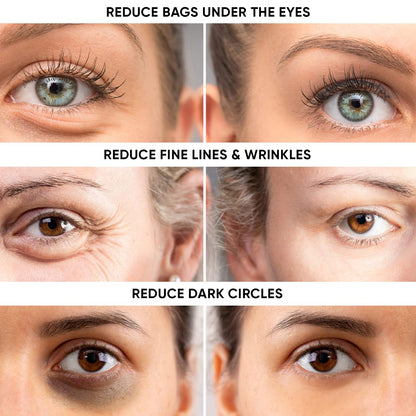 Instant Eye Tightener - Fast-Acting Under Eye Bag & Dark Circle Remover (15ml)