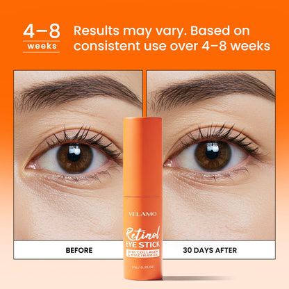 VELAMO ADVANCED Retinol Eye Stick Duo (2 Pcs) - Korean Upgraded Formula with Collagen, Niacinamide & Peptides (10g x 2)