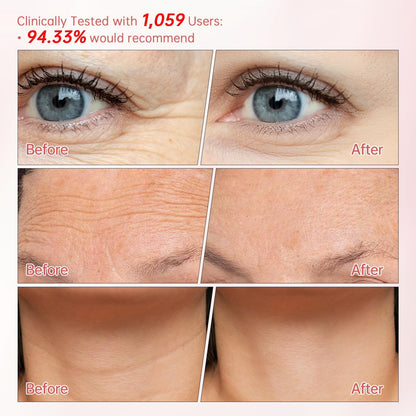 Peunitory Eye Balm Stick - Anti-Wrinkle & Brightening (0.32oz)