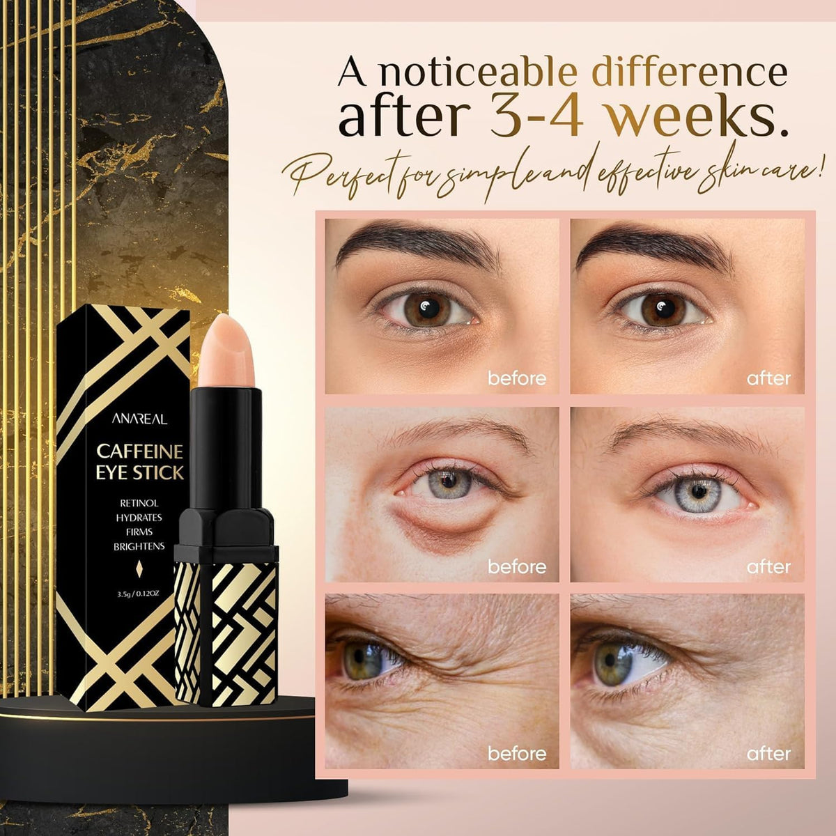 Caffeine Under Eye Balm Stick – Hydrating Eye Brightener with Retinol for Dark Circles & Puffiness
