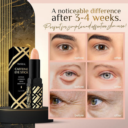 Caffeine Under Eye Balm Stick – Hydrating Eye Brightener with Retinol for Dark Circles & Puffiness