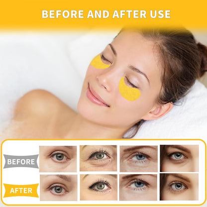 Qyiywim 24K Gold Under Eye Patches – 70 PCS Eye Gel Pads for Dark Circles, Puffiness & Eye Bags