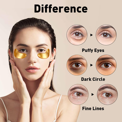 CHMI 24K Gold Under Eye Patches (50 Pairs) – Collagen Eye Masks for Dark Circles, Puffy Eyes, Eye Bags & Wrinkles – Hydrating Anti-Aging Eye Gel Pads