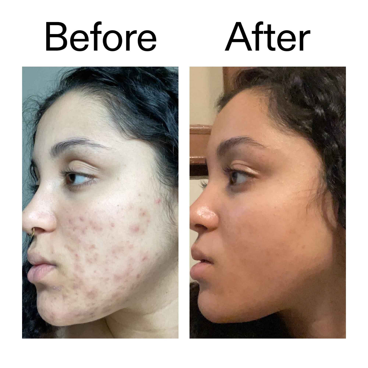 The INKEY List Tranexamic Acid Serum