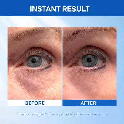 HealthyDerm Instant Under Eye Lift Serum - Anti-Aging & Firming (20ml)