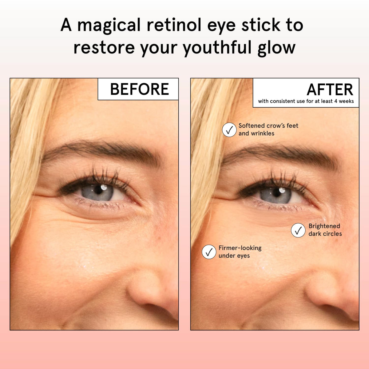 grace & stella Retinol & Caffeine Eye Brightener Balm Stick (3.5g) - Travel-Size Anti-Aging Treatment for Dark Circles, Puffiness & Wrinkles | Vegan Eye Cream Stick