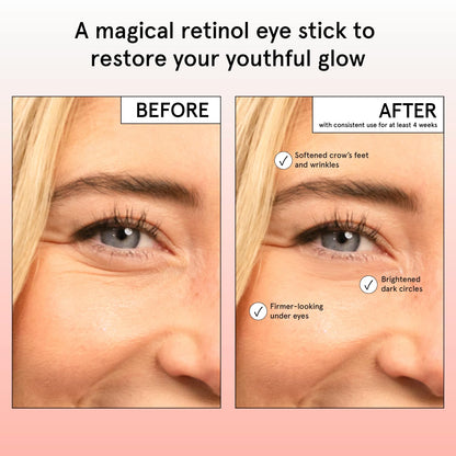 grace & stella Retinol & Caffeine Eye Brightener Balm Stick (3.5g) - Travel-Size Anti-Aging Treatment for Dark Circles, Puffiness & Wrinkles | Vegan Eye Cream Stick