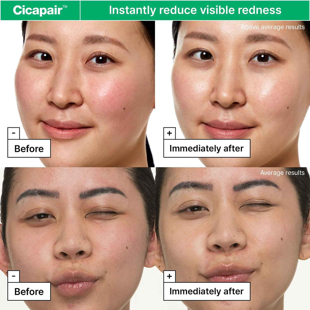 Dr.Jart+ Cicapair Sensitive Skin Korean Face Moisturizer for Redness and Barrier Repair with Centella Asiatica - Korean Skin Care - Travel Size, 0.51 Fl Oz