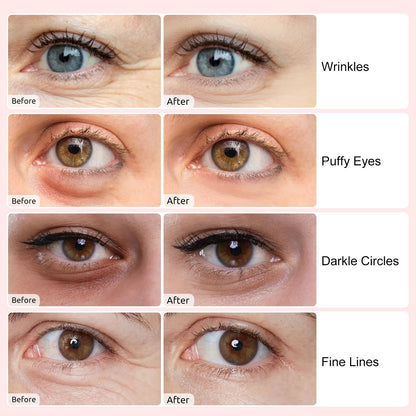 Permotary Collagen Crystal Eye Masks - Value Pack (40 Pairs)
