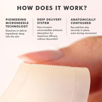skyn ICELAND Dissolving Microneedle Under-Eye Patches - 39% Hyaluronic Acid & Peptides - Deep Hydration Overnight Mask (3 Pairs)