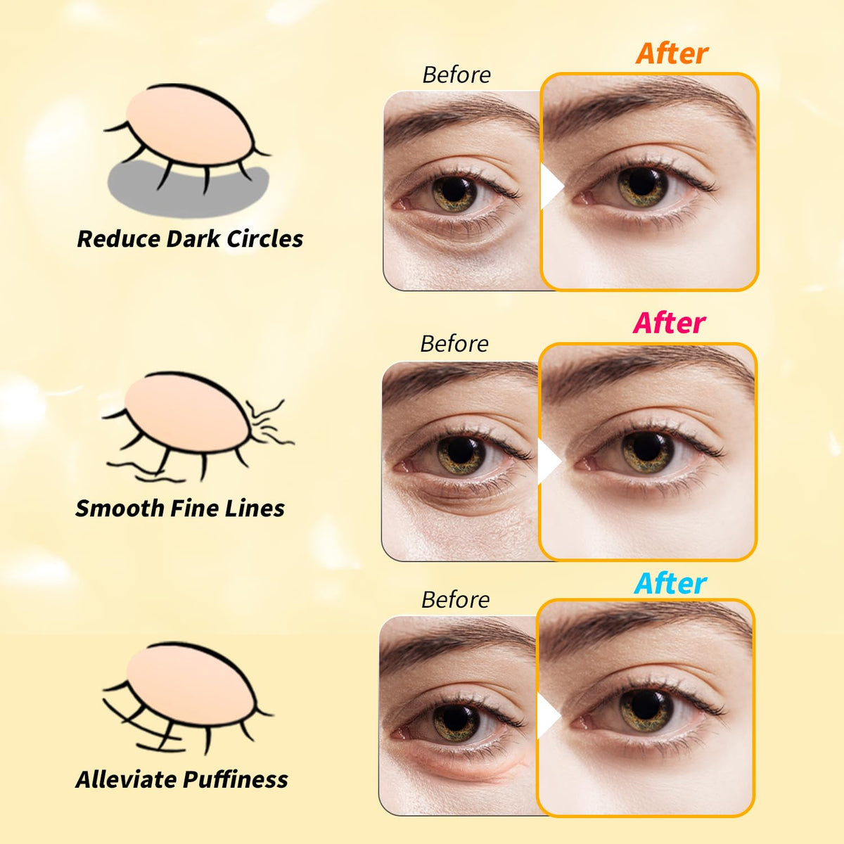 24K Gold & Retinol Eye Patches - Caffeine Infused Eye Mask for Puffy Eyes, Dark Circles & Wrinkles - Restoring Treatment (48 Pairs)