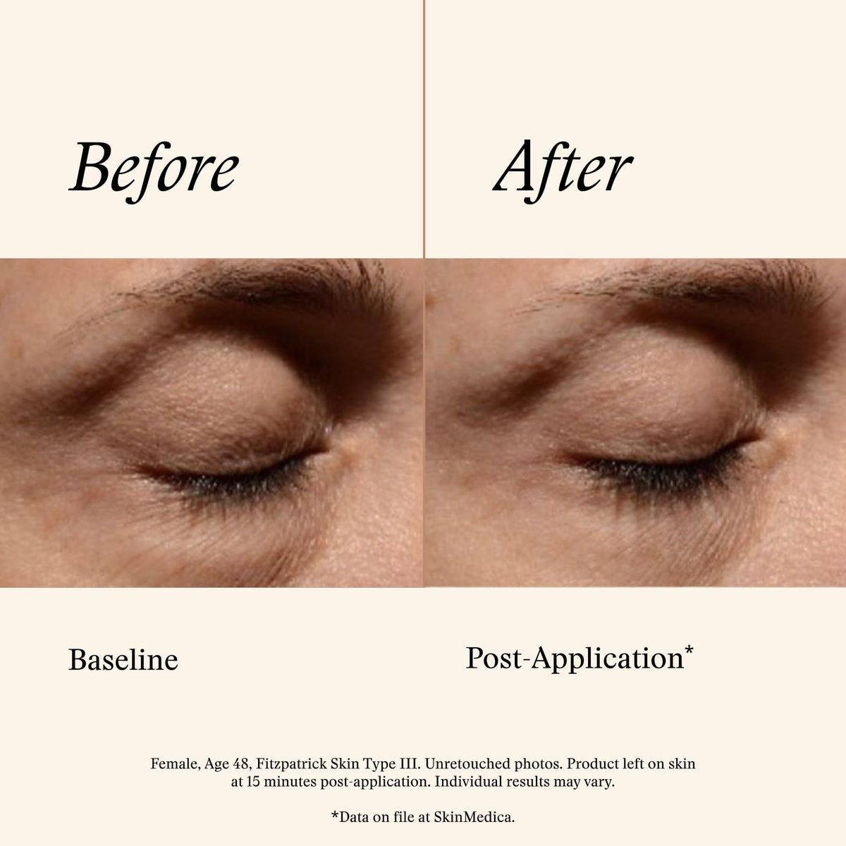SkinMedica Instant Bright Eye Cream – Advanced Age-Defying (15g)