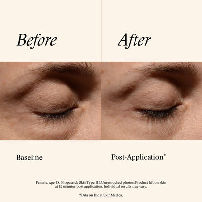 SkinMedica Instant Bright Eye Cream – Advanced Age-Defying (15g)