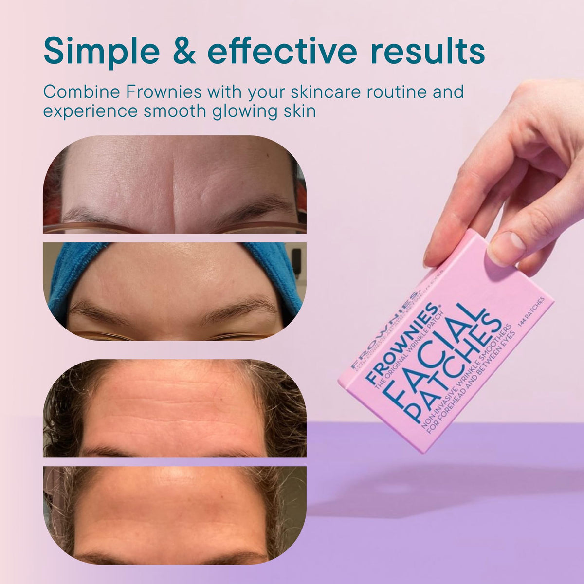 Frownies Forehead & Between Eyes Wrinkle Patches (144 Patches) - Overnight Treatment for Forehead Lines & Eleven Lines
