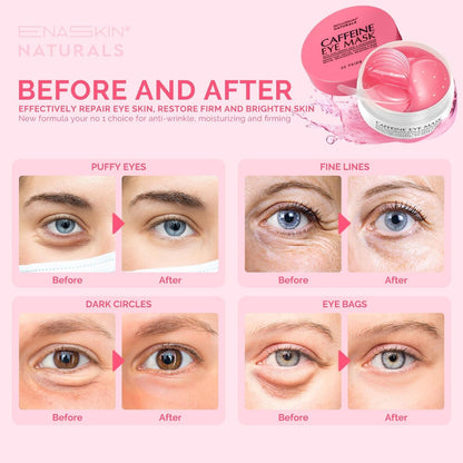 Under Eye Patches for Puffiness Kit - Green Tea & Caffeine (120 Pcs)