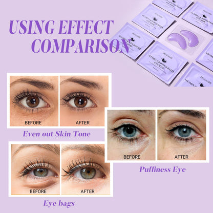 PEAUAMIE Under Eye Patches (30 Pairs) – Brightening Vitamin C & Soothing Witch Hazel Eye Mask for Dark Circles & Puffiness