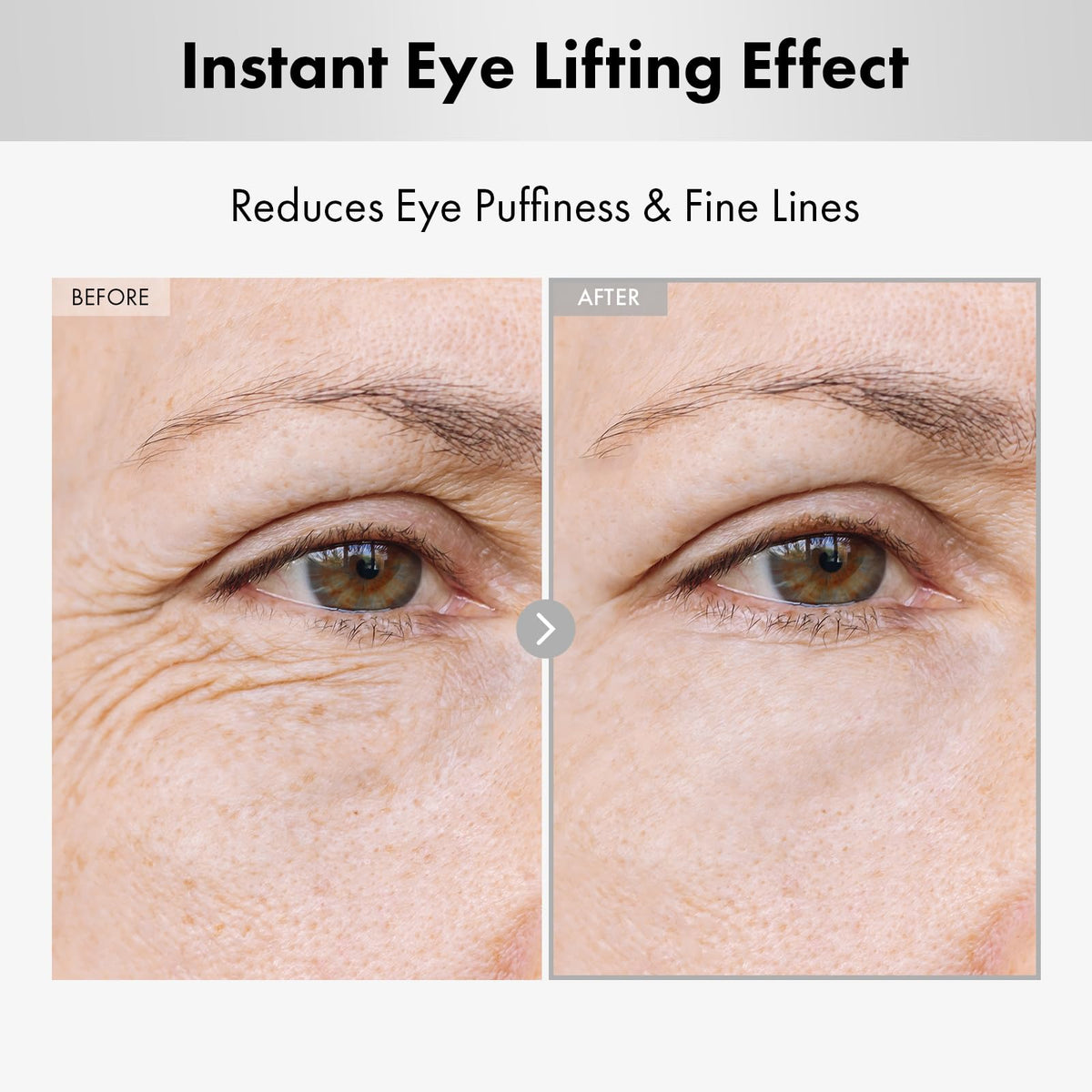 NATUREKIND Hyaluron Lifting Eye Cream - 5% Arbutin & Hyaluron (15ml)