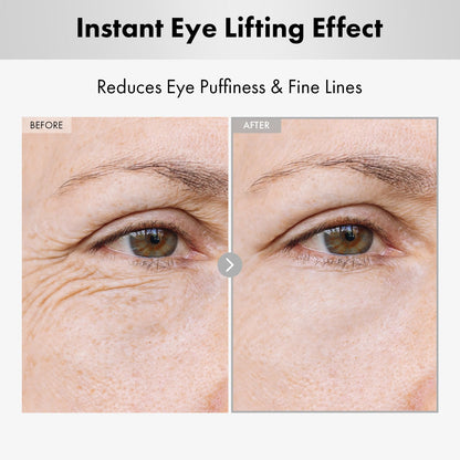NATUREKIND Hyaluron Lifting Eye Cream - 5% Arbutin & Hyaluron (15ml)