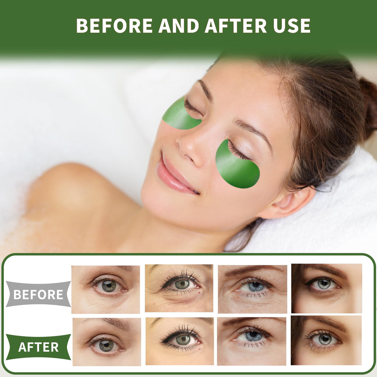 Qyiywim Green Tea Under Eye Patches – 70 PCS Eye Gel Pads for Dark Circles, Puffiness & Eye Bags