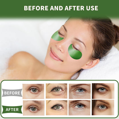 Qyiywim Green Tea Under Eye Patches – 70 PCS Eye Gel Pads for Dark Circles, Puffiness & Eye Bags
