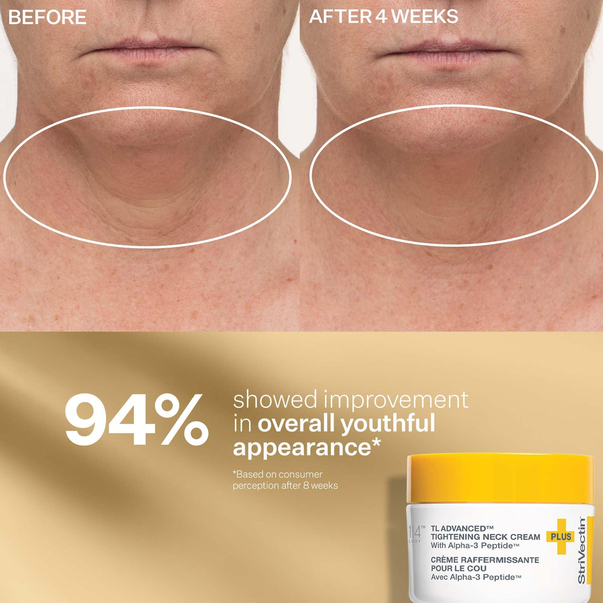 StriVectin Tighten & Lift Anti-Aging Trio Kit - 3-Piece Peptide Set for Face, Eyes & Neck (Wrinkles & Firming)