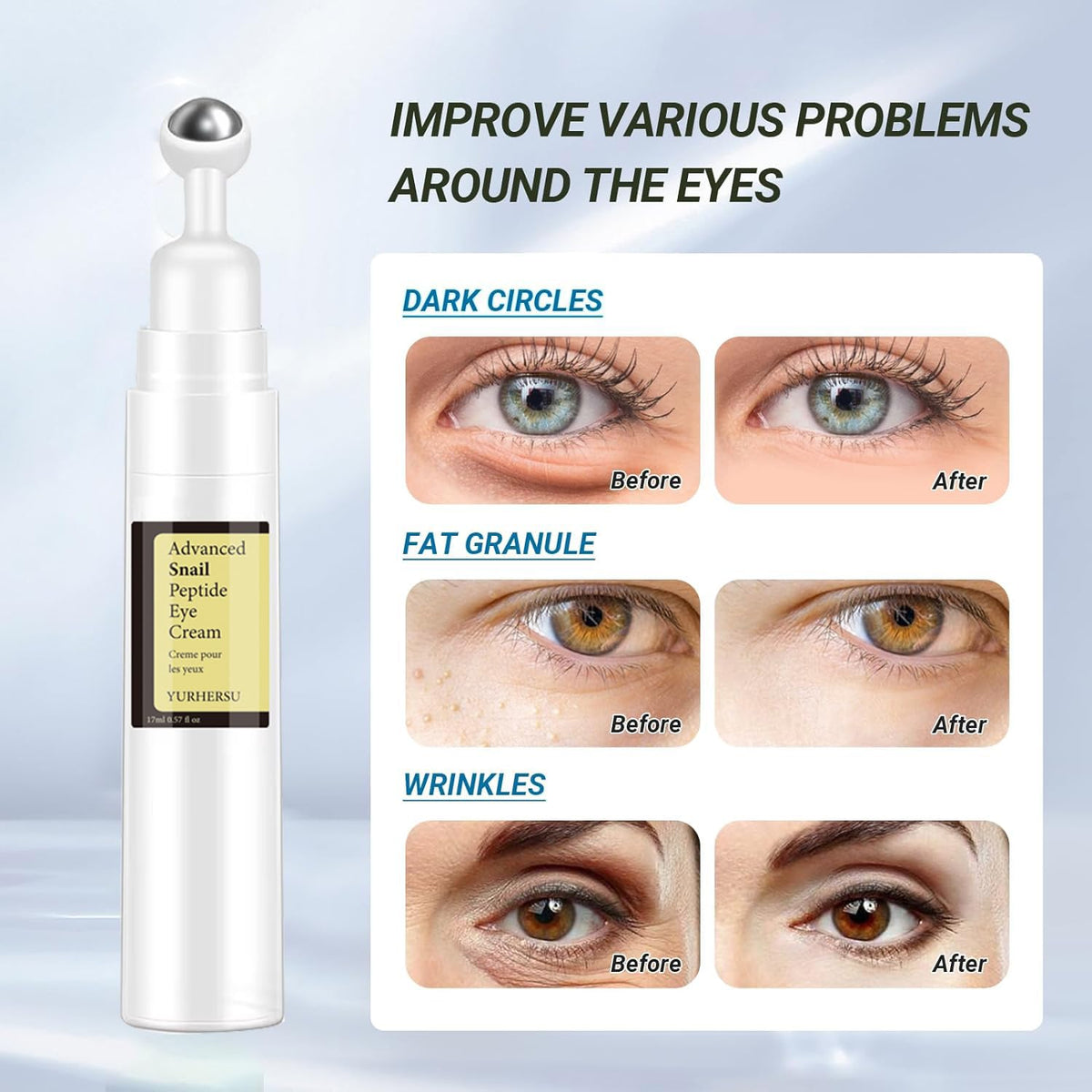 ELCHHIRSCH Snail Peptide Under Eye Cream - 73% Snail Mucin & 2% Nicotinamide with 360° Massaging Roller Ball (0.57 fl. oz)