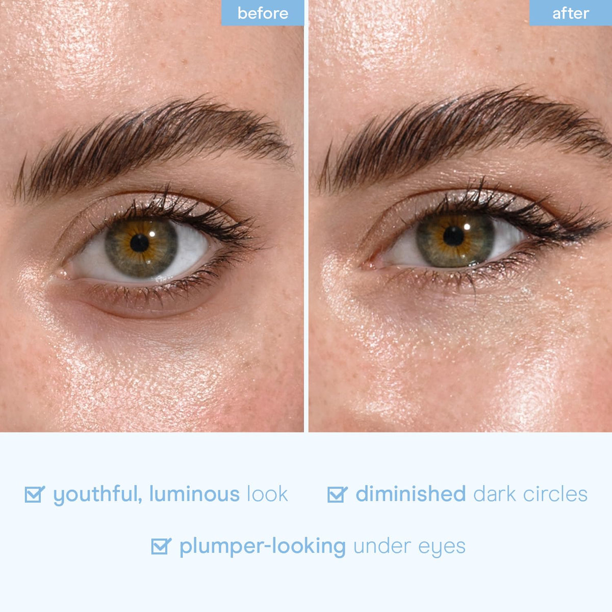 Baebody Advanced Snail Mucin Under Eye Patches (6 Pairs)