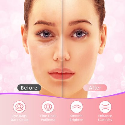 USTELIR Rose Under Eye Patches - 40 Pairs - Soothing Eye Masks for Dark Circles, Puffy Eyes & Wrinkles