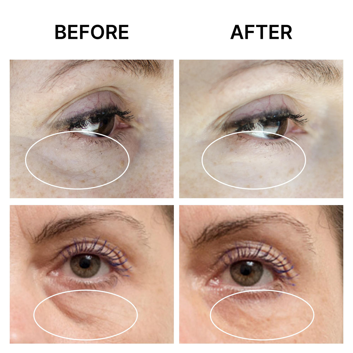 SEAMANTIKA PUFFINESS AWAY Eye Cream - Instant Eye Bag Remover & Puffiness Reducer with Eyeliss™ & Vitamin C (0.8 fl. oz)