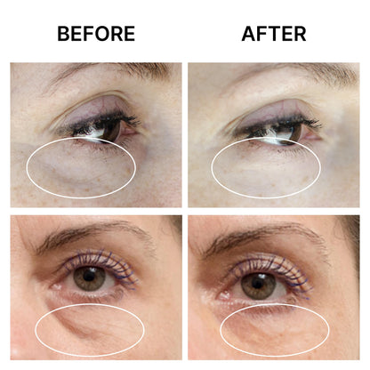 SEAMANTIKA PUFFINESS AWAY Eye Cream - Instant Eye Bag Remover & Puffiness Reducer with Eyeliss™ & Vitamin C (0.8 fl. oz)