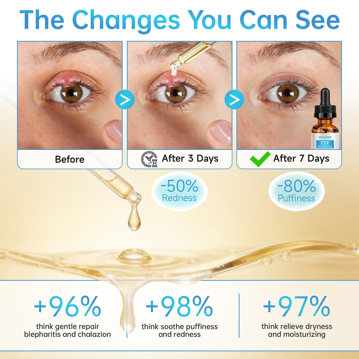 Soothing Eye Serum for Chalazion & Blepharitis Support - Eyelid Treatment with Avocado Oil, Sea Buckthorn & Caffeine (1 fl. oz / 30ml)