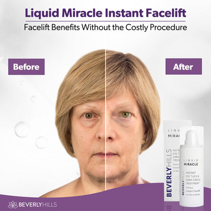 Beverly Hills Instant Facelift & Eye Serum - 30mL (120 Day Supply) - Rapid Reduction Treatment for Bags, Wrinkles & Dark Circles