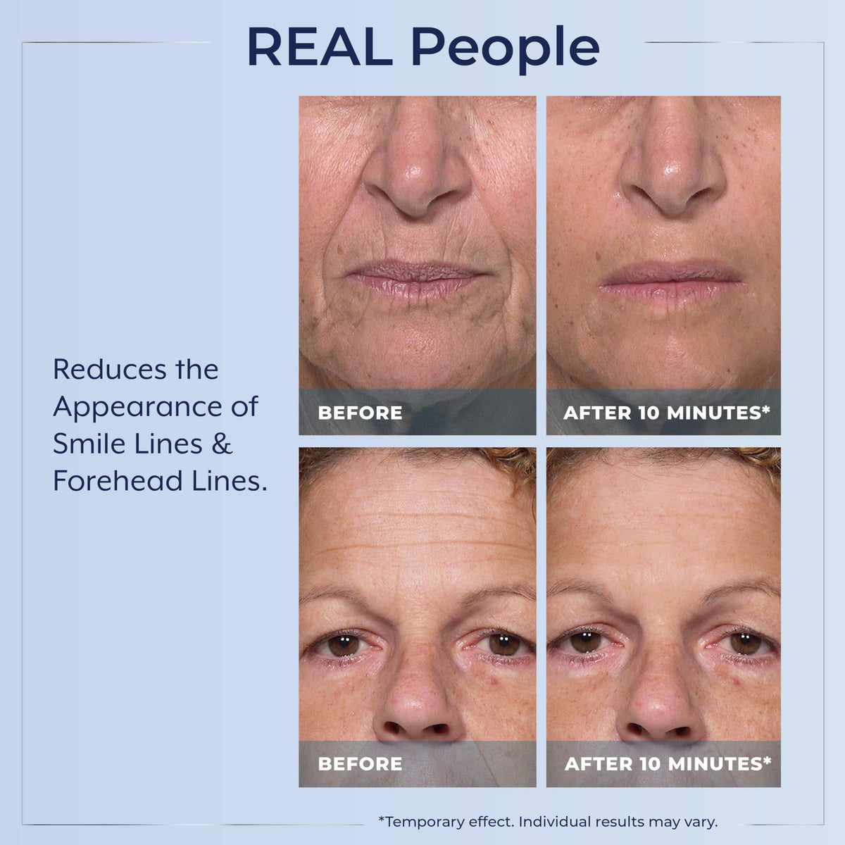 Plexaderm Rapid Reduction Eye Serum - 3 Full Size Tubes - Instant Visible Reduction of Eye Bags, Wrinkles & Dark Circles