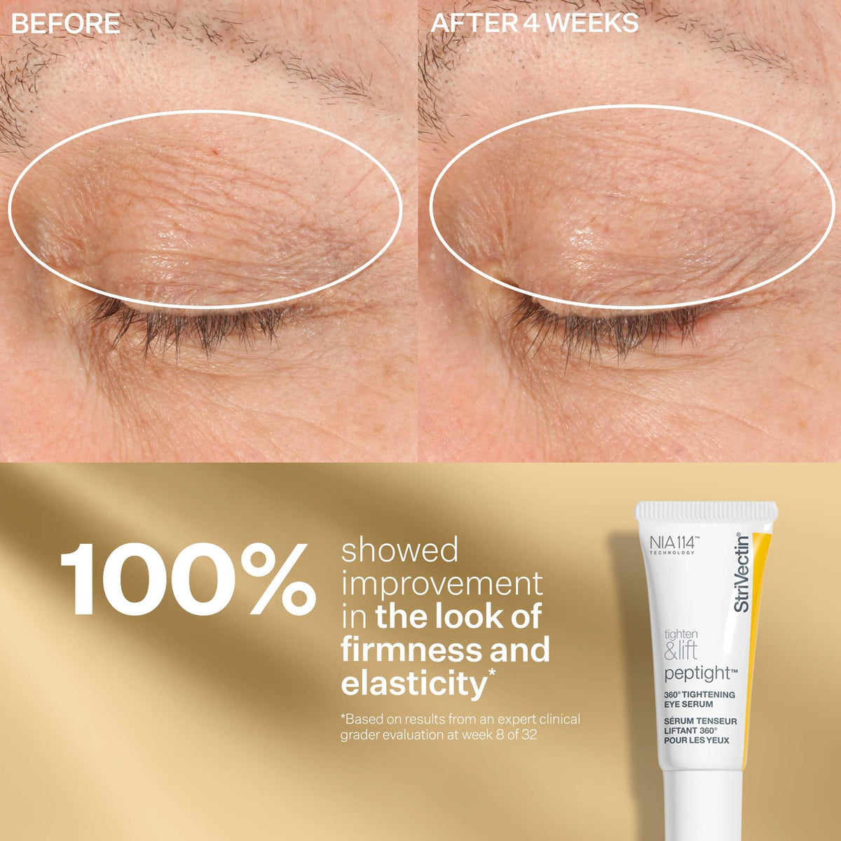 StriVectin Tighten & Lift Anti-Aging Trio Kit - 3-Piece Peptide Set for Face, Eyes & Neck (Wrinkles & Firming)