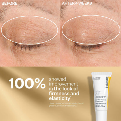 StriVectin Tighten & Lift Anti-Aging Trio Kit - 3-Piece Peptide Set for Face, Eyes & Neck (Wrinkles & Firming)