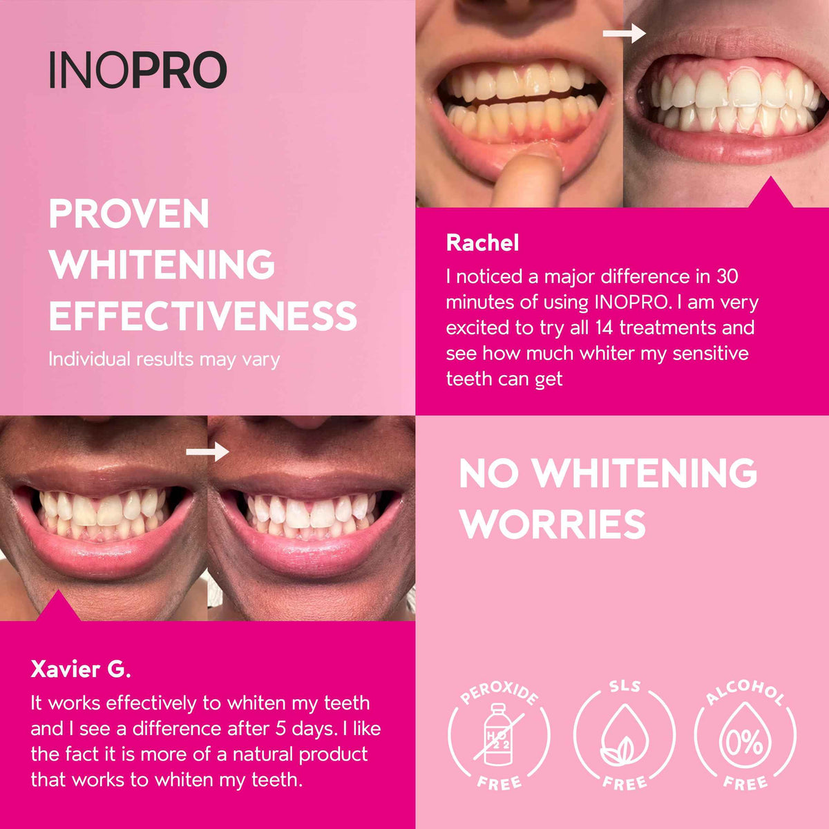 InoPro Teeth Whitening Strips 14 Treatments Kit - Enamel Safe Teeth Whitener, Peroxide-Free, Green White Strips