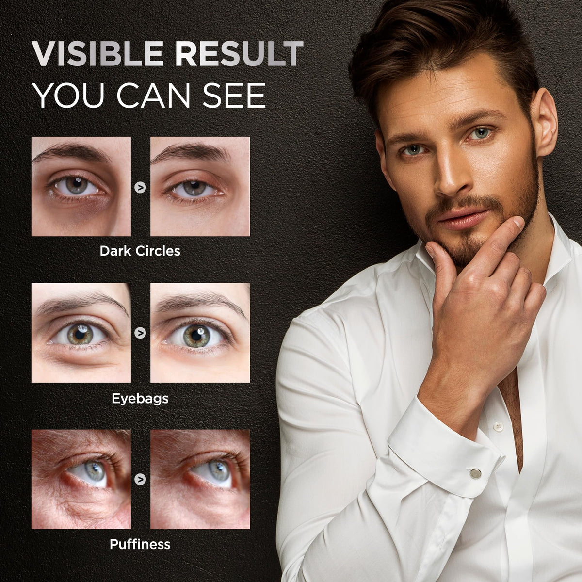 RAZONIX Eye Bags Treatment for Men - Caffeine Eye Roller (Medium)