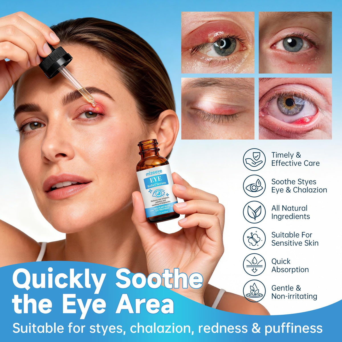 Soothing Eye Serum for Chalazion & Blepharitis Support - Eyelid Treatment with Avocado Oil, Sea Buckthorn & Caffeine (1 fl. oz / 30ml)