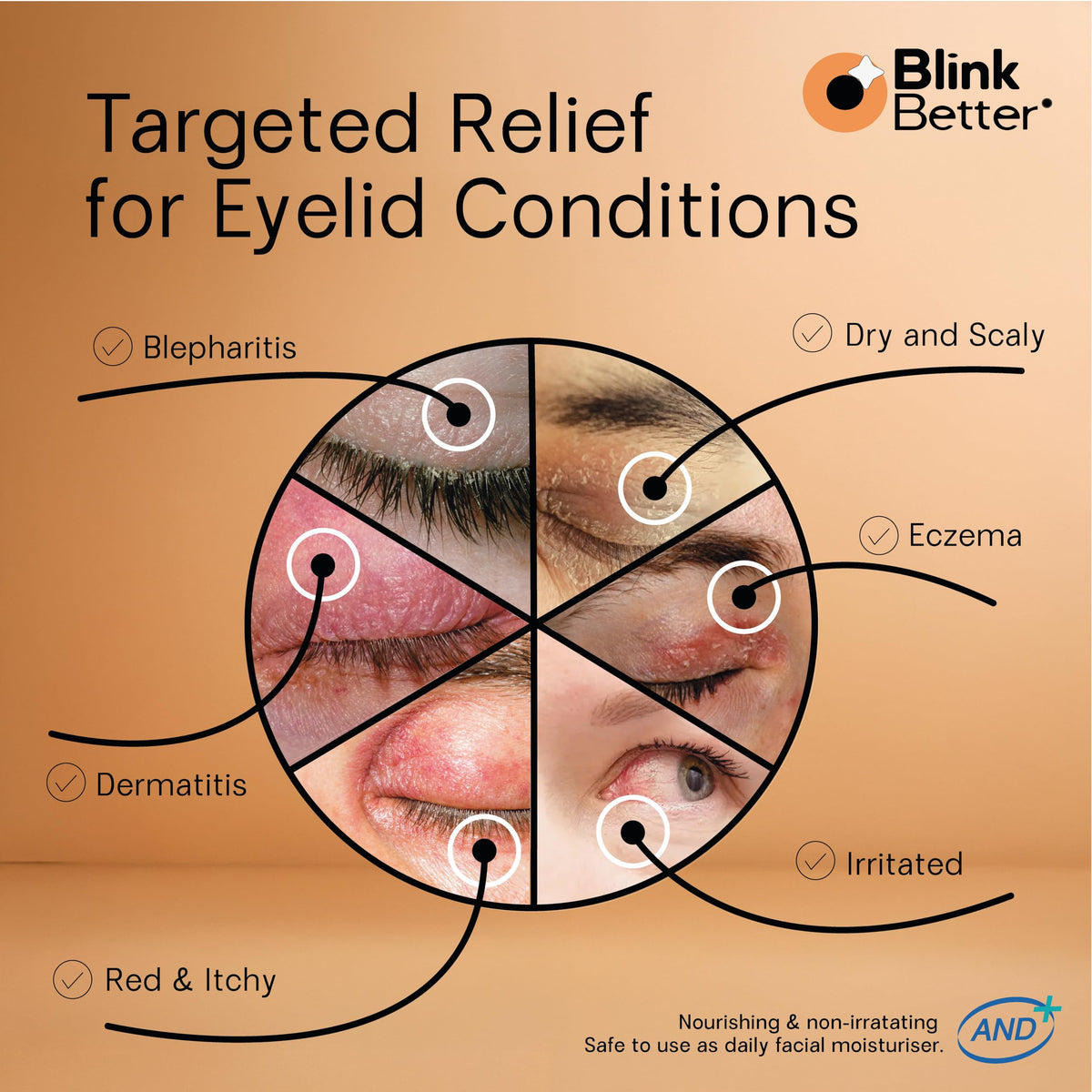 BlinkBetter BetterLids Restore Eyelid Cream - Hydrating Barrier Support for Dry, Red & Sensitive Eyelids - 3% Oat & Ceramides (1 fl oz.)