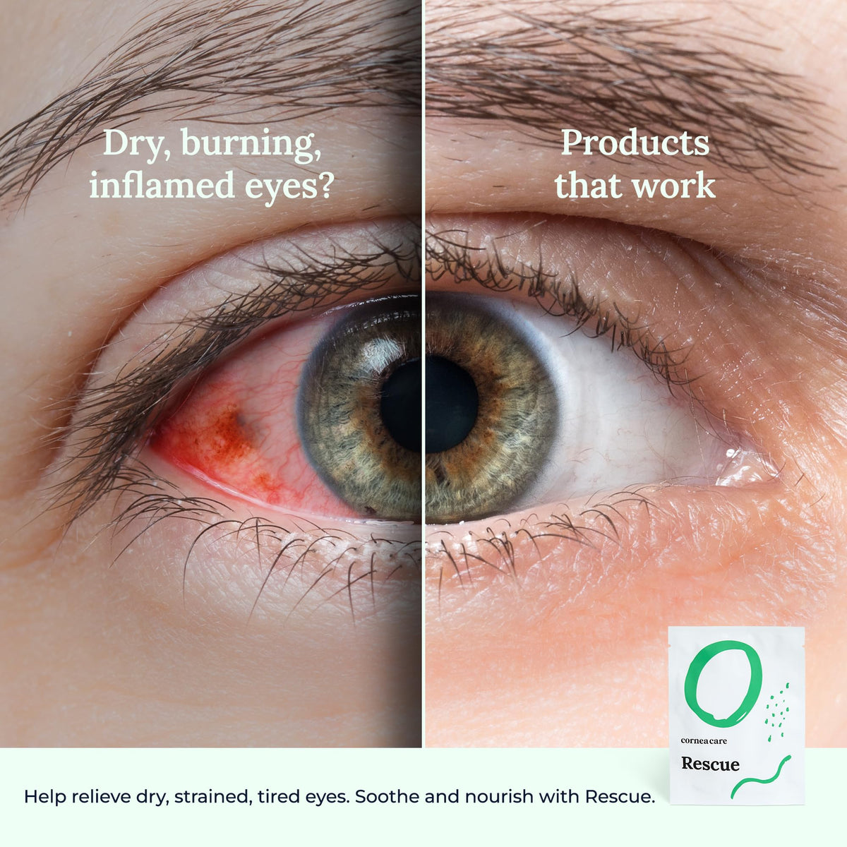 CorneaCare Rescue: Self-Cooling Hydrogel Eye Compress (12 Count) - Instant Relief for Puffy, Tired & Dry Eyes