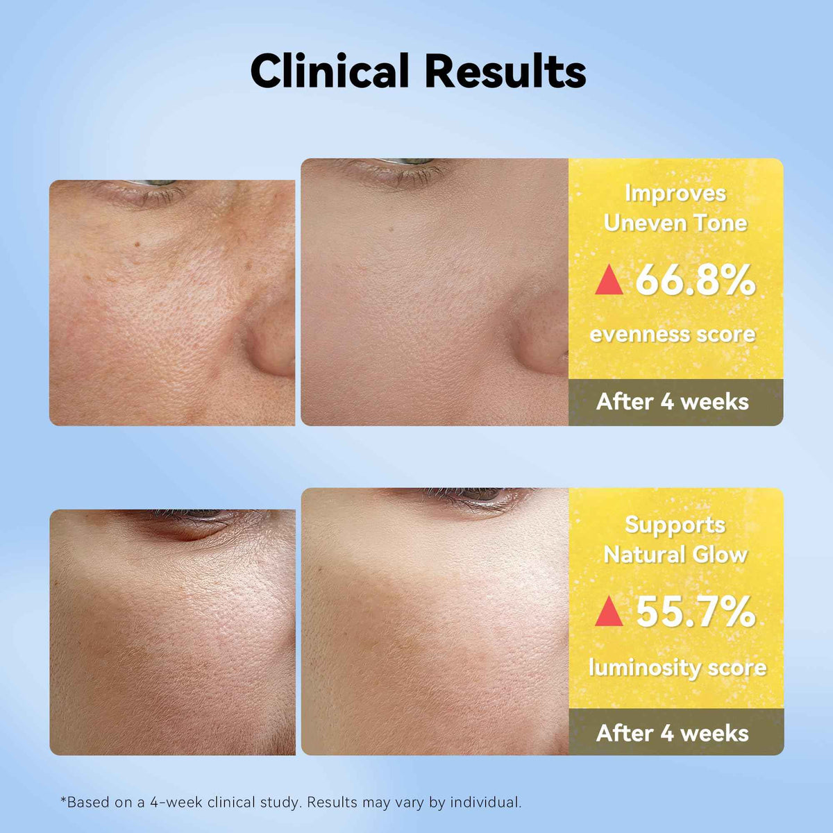 XIANUI Deep Vitamin Radiance Serum - 5% Niacinamide + TXA + Vitamin C - Brightening & Hydrating Face Serum with Ceramide & Triple Hyaluronic Acid