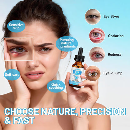 Soothing Eye Serum for Chalazion & Blepharitis Support - Eyelid Treatment with Avocado Oil, Sea Buckthorn & Caffeine (1 fl. oz / 30ml)