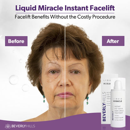Beverly Hills Instant Facelift & Eye Serum - 30mL (120 Day Supply) - Rapid Reduction Treatment for Bags, Wrinkles & Dark Circles