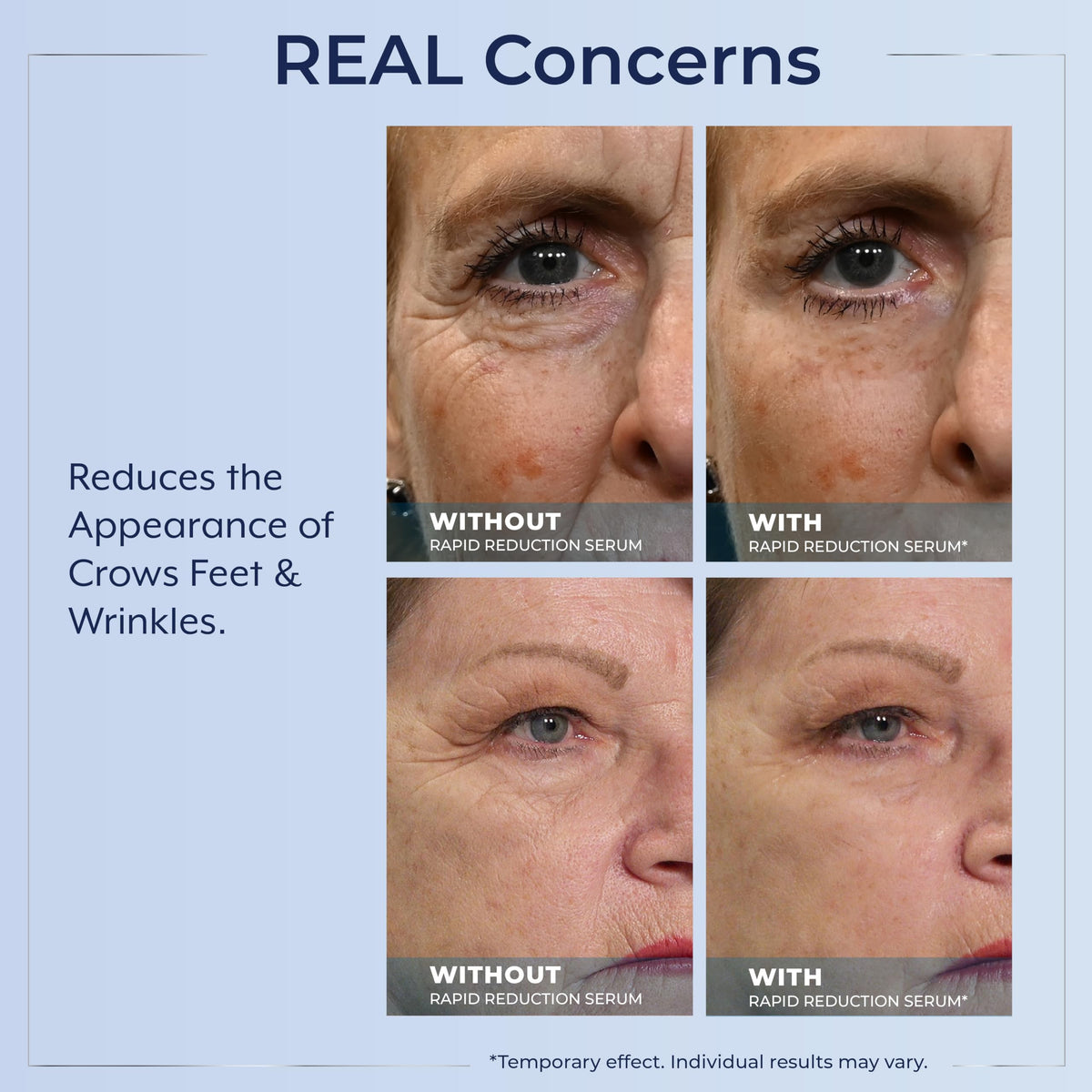 Plexaderm Rapid Reduction Eye Serum - 3 Full Size Tubes - Instant Visible Reduction of Eye Bags, Wrinkles & Dark Circles
