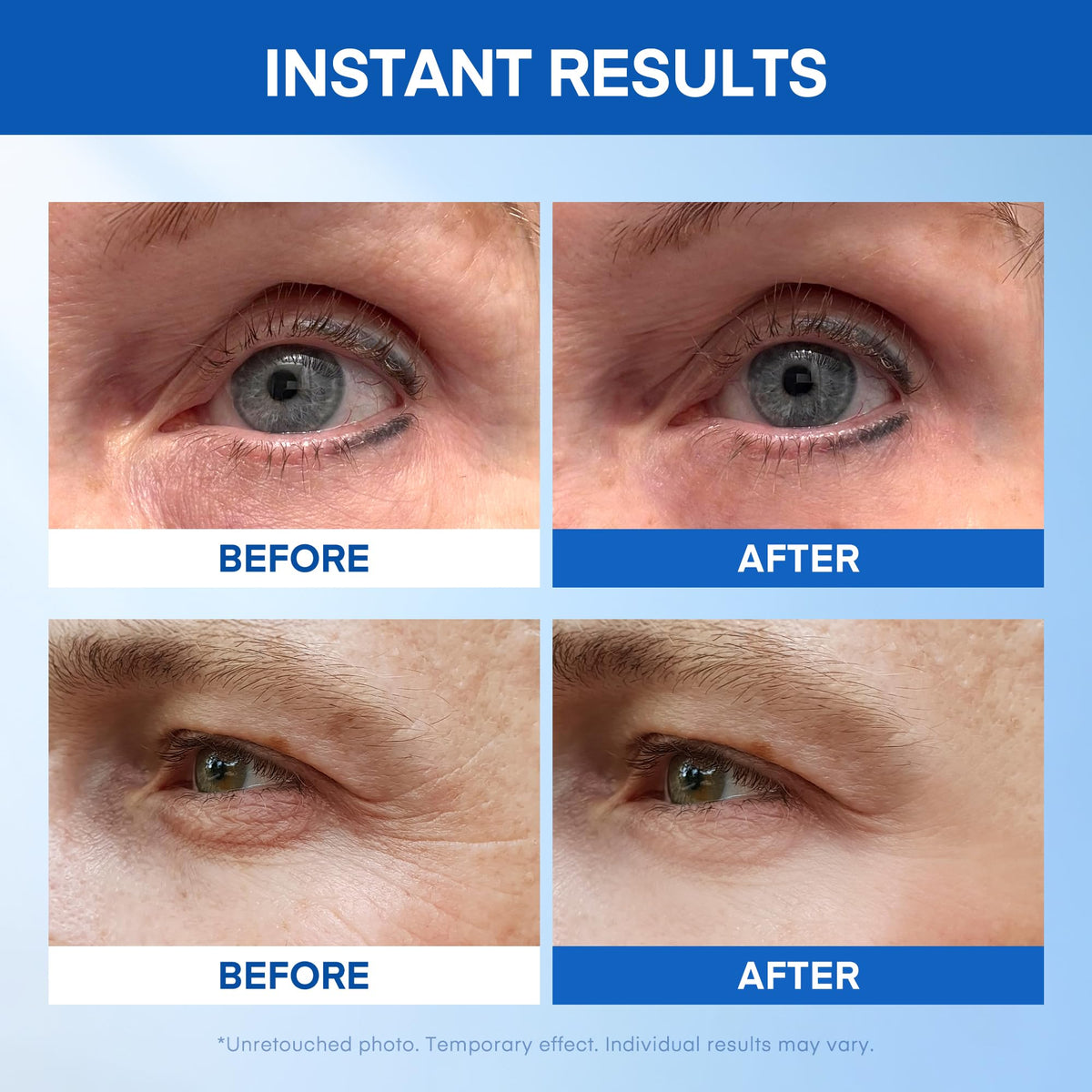 Instant Under Eye Lift Serum – Advanced Firming Polysaccharide (20 Tubes)