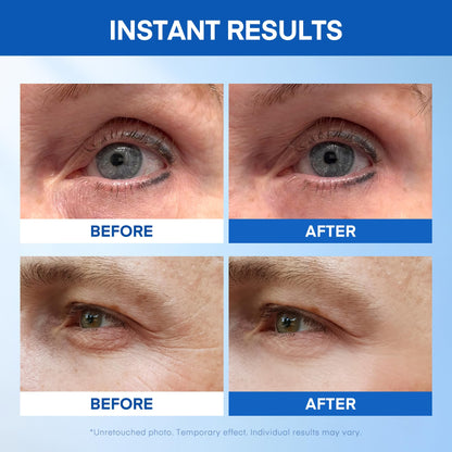 Instant Under Eye Lift Serum – Advanced Firming Polysaccharide (20 Tubes)